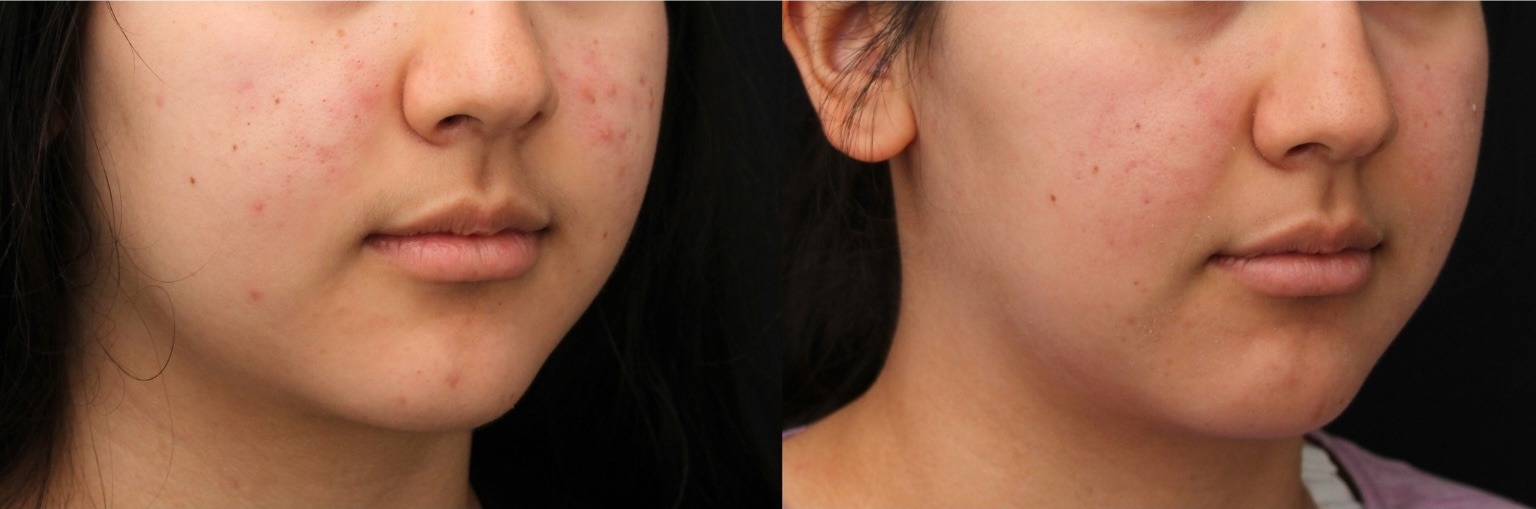 pricing brochure detailing Indianapolis plastic surgery cost ranges
